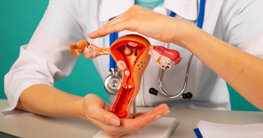 Understanding Uterine Fibroids: Risks, Diagnosis, and Natural Treatments for a Bulky Uterus