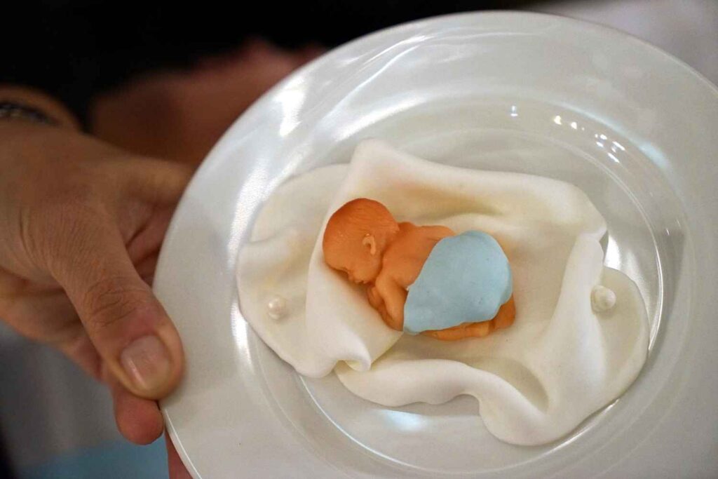 IVF Egg Retrieval