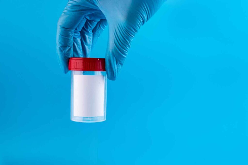 Low Sperm Count Treatment in Hyderabad