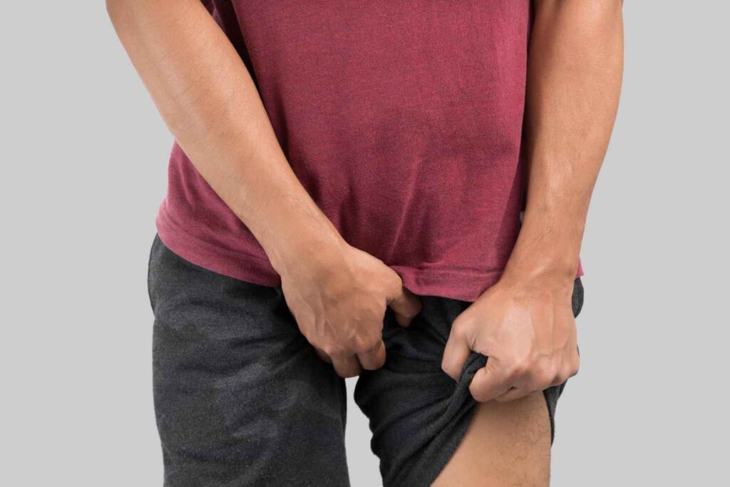 Varicocele