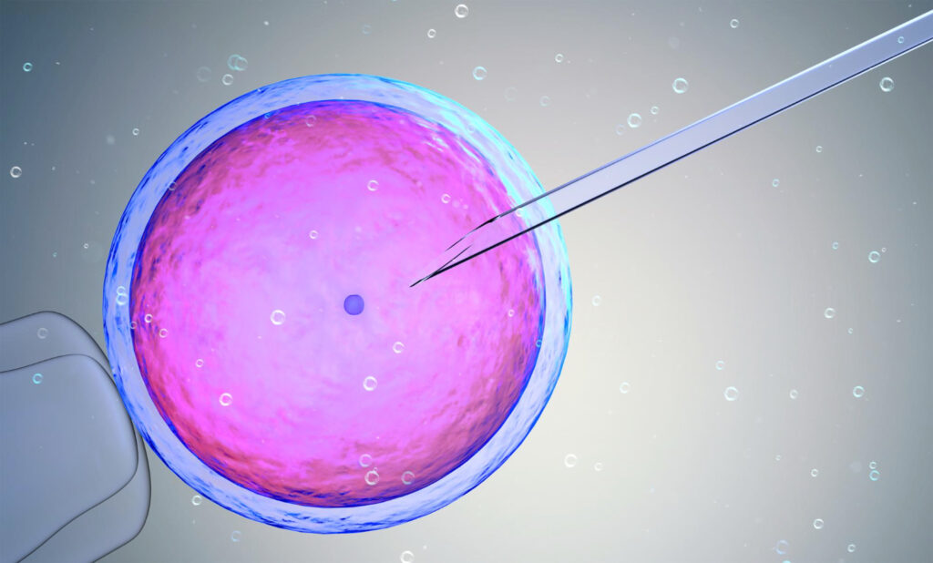 IUI Treatment