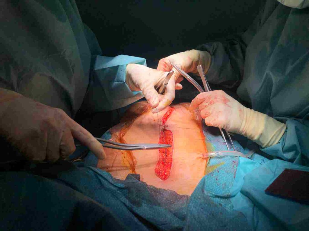 Laparoscopy in Infertility Treatment