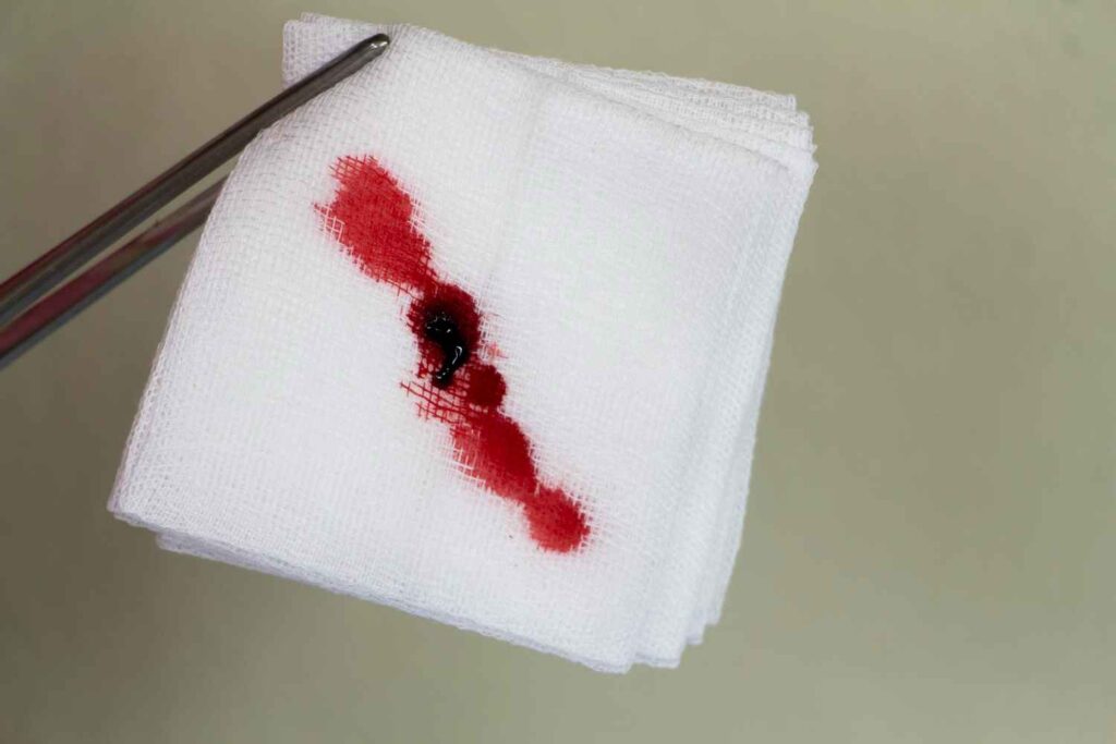 Implantation Bleeding vs Period