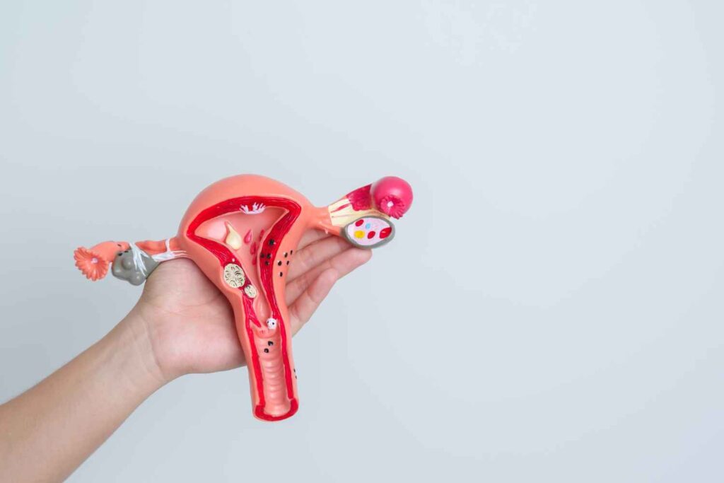 Pain After Sex? Endometriosis Might Be the Cause