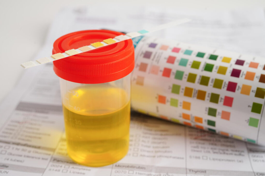 Urine Colour Changes During Pregnancy